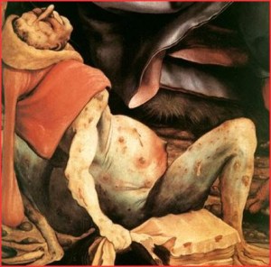 Detail of Bosch painting illustrating a victim of St. Anthony's fire